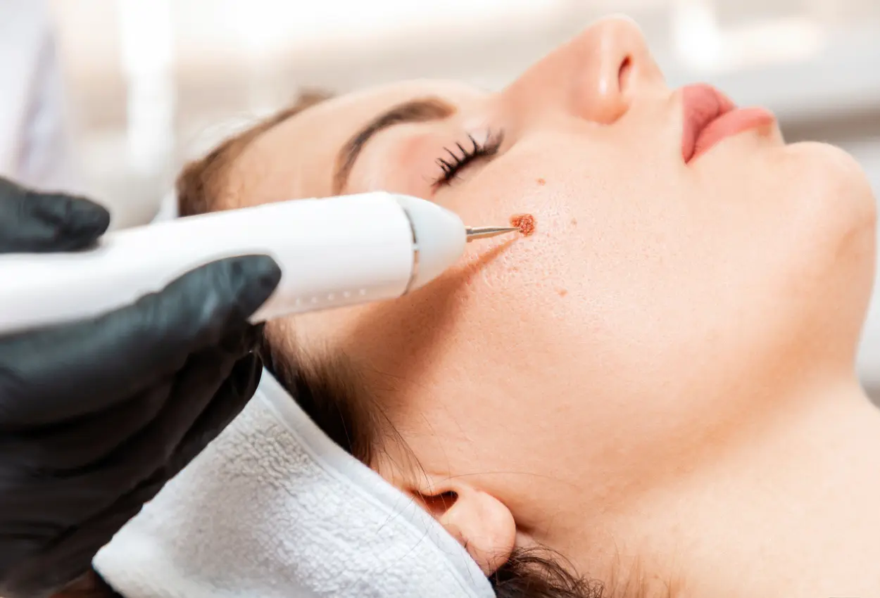 Frequently Asked Questions About Multiple Cryotherapy Treatments Stourbridge